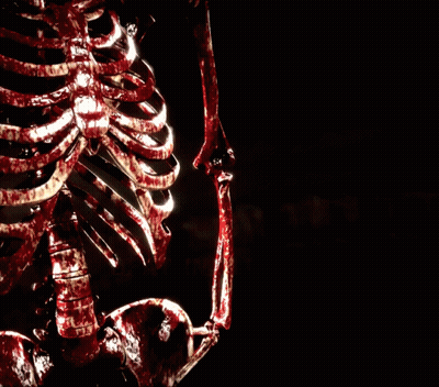 W Flawless Victory Skeleton Poster GIF