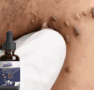 Wart Remover Bottle Next To Neck GIF