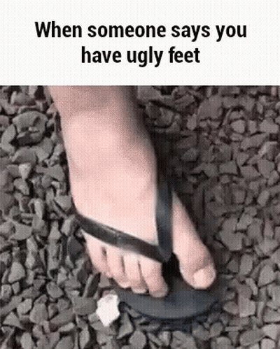 When Someone Says You Have Ugly Feet , A Person Is Wearing A Flip Flop . GIF