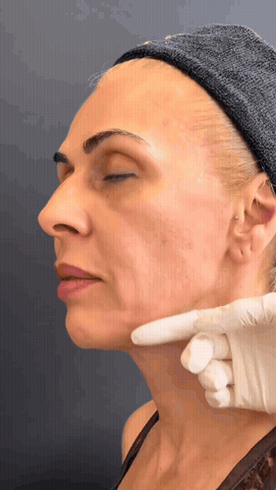 Woman Eyes Closed Examined By Gloved Hand GIF