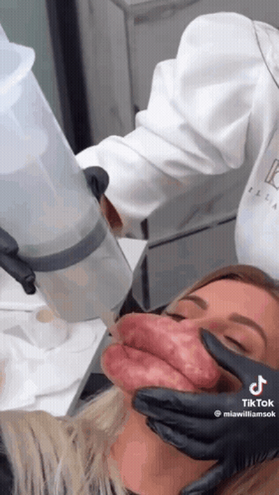 Woman Getting Botox Treatment GIF