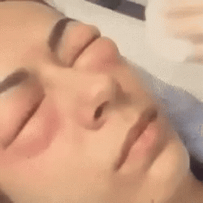 Woman Getting Facial Treatment With Syringe GIF