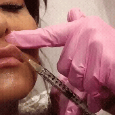 Woman Getting Lip Injection GIF