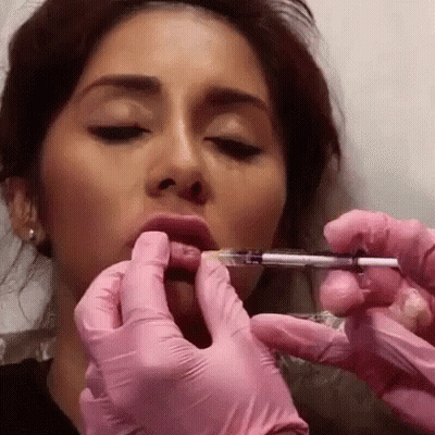 Woman Getting Lip Injection With Pink Gloves GIF