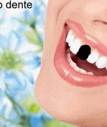Woman Wide Smile With Missing Teeth Moving  GIF