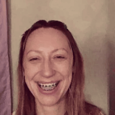 Woman With Braces Smiling GIF