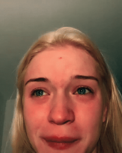 Woman With Red Forehead Spot Making Funny Face GIF