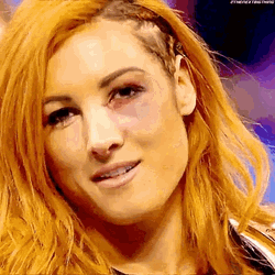 WWE Wrestler Becky Lynch Having Black Eye GIF