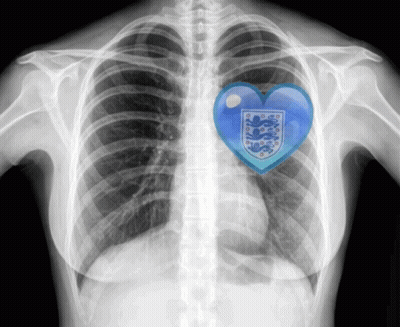 X-Ray Chest Blue Heart England Crest GIF