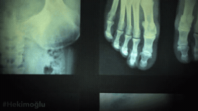 X-Ray Of Foot With Hashtag Hekimoglu GIF
