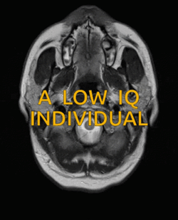 You Are An Idiot Low IQ Brain GIF