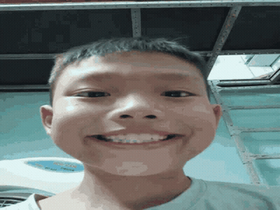Young Boy With Braces Making Funny Face GIF