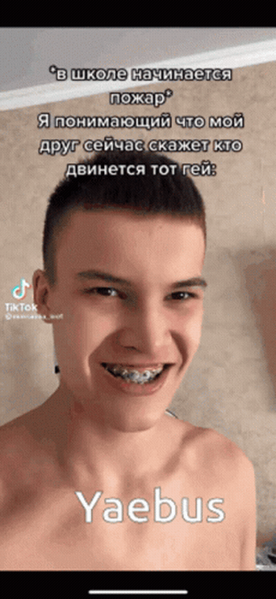 Young Man With Braces And Yaebus On Phone GIF