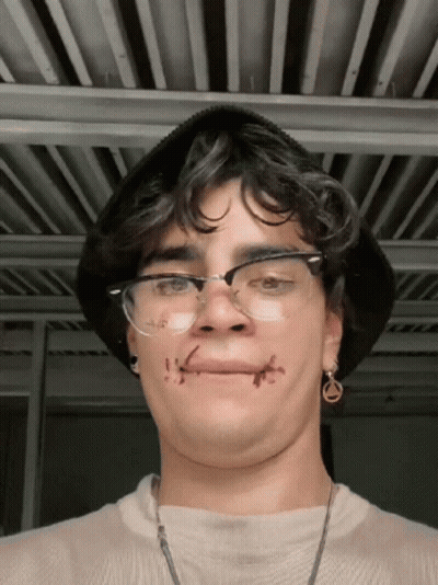 Young Man With Glasses And Stitches GIF